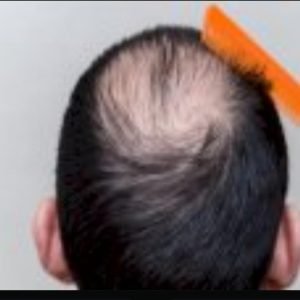 ملء الفراغ