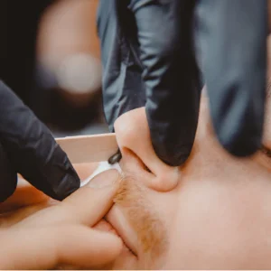 إزالة شعر الانف